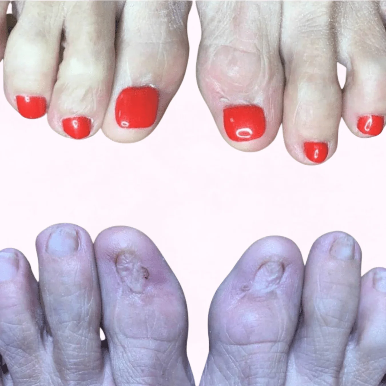 nail reconstruction before and after 4
